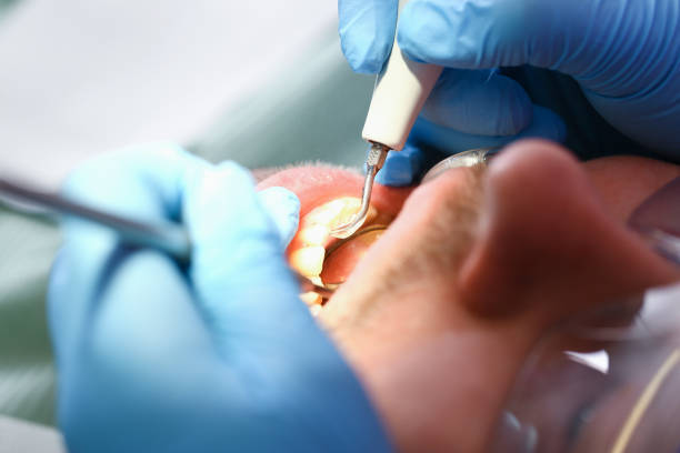 Best Emergency Treatment for Toothache in Oliver Springs, TN